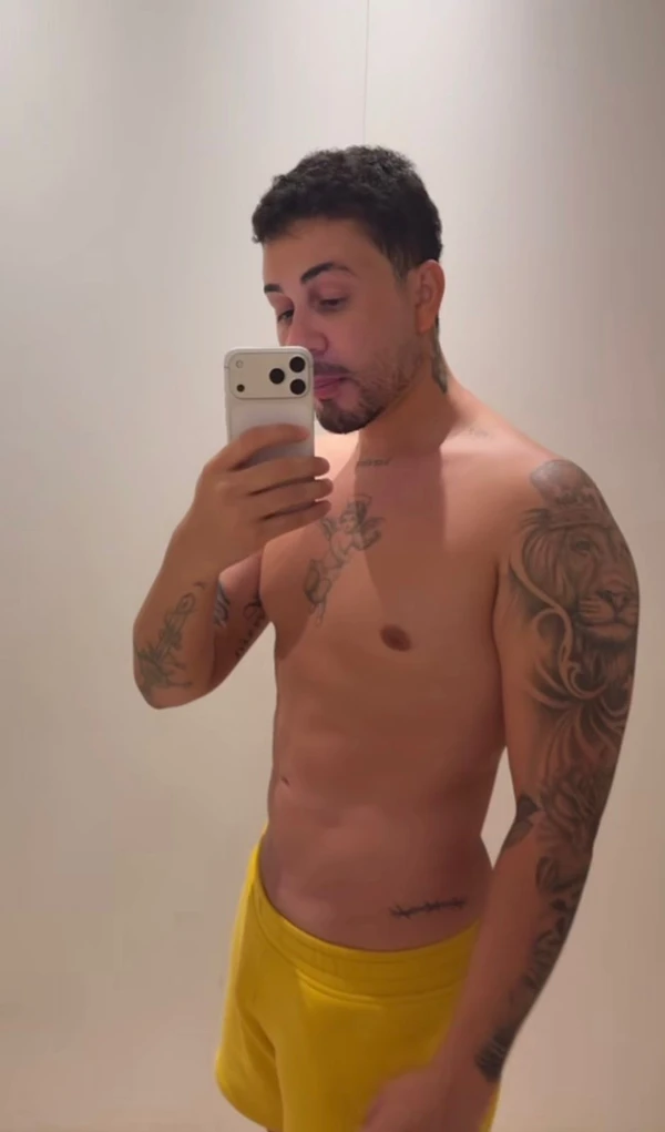 Carlinhos Maia depois do procedimento estético por Reprodução/Instagram