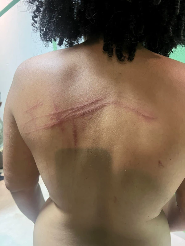 “Ali era um massacre”: Ex-internos denunciam tortura e fome em centro terapêutico na Bahia por Leitor Correio