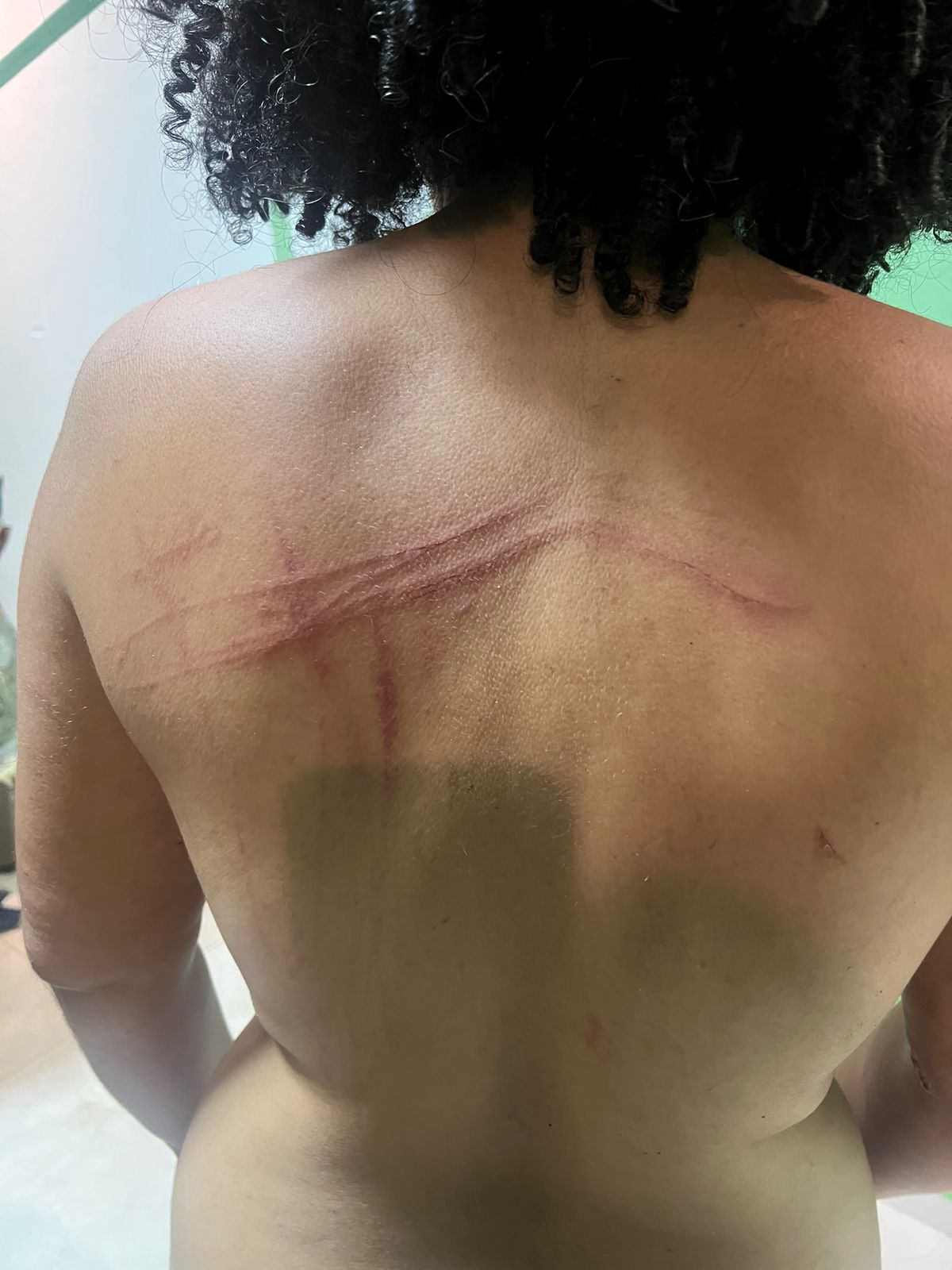 “Ali era um massacre”: Ex-internos denunciam tortura e fome em centro terapêutico na Bahia por Leitor Correio