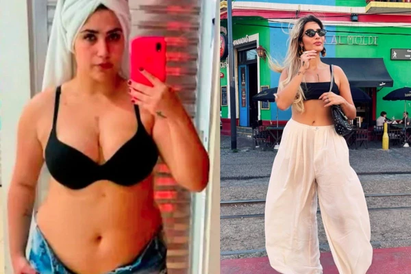 Antes e depois de Jéssica Beatriz