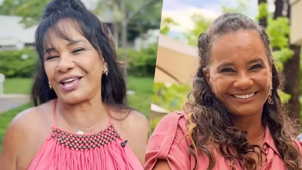 Ex-BBBs surgem repaginados antes da final com botox, lifting e novo visual por Reprodução