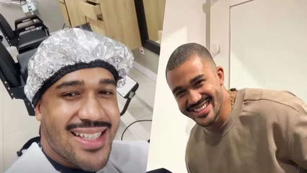 Ex-BBBs surgem repaginados antes da final com botox, lifting e novo visual por Reprodução