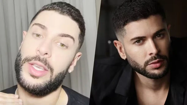 Ex-BBBs surgem repaginados antes da final com botox, lifting e novo visual por Reprodução