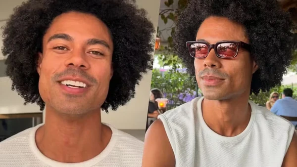 Ex-BBBs surgem repaginados antes da final com botox, lifting e novo visual por Reprodução