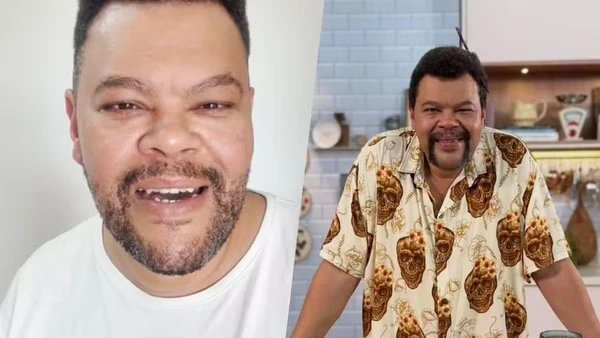 Ex-BBBs surgem repaginados antes da final com botox, lifting e novo visual por Reprodução