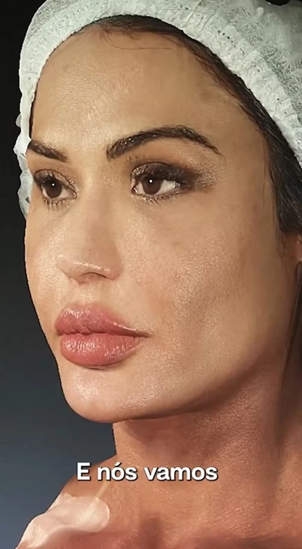 Gracyanne Barbosa muda estética do rosto por Reprodução