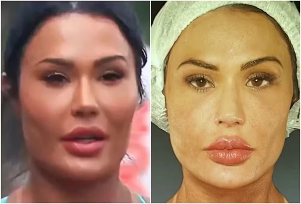 Gracyanne Barbosa muda estética do rosto por Reprodução