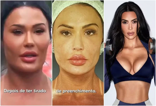Gracyanne Barbosa muda estética do rosto por Reprodução
