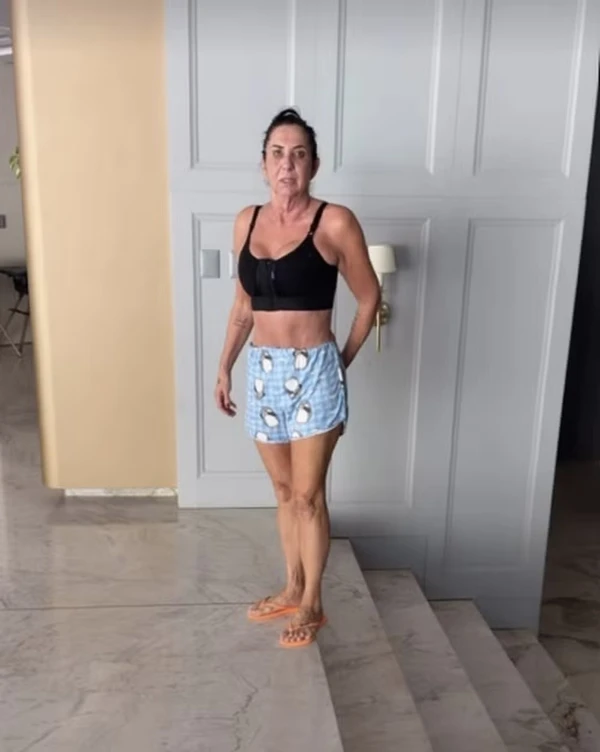 Margareth Serrão surge irreconhecível após plásticas e Virginia reage por Reprodução Instagram