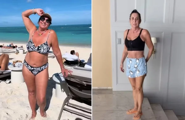 Margareth Serrão surge irreconhecível após plásticas e Virginia reage por Reprodução Instagram