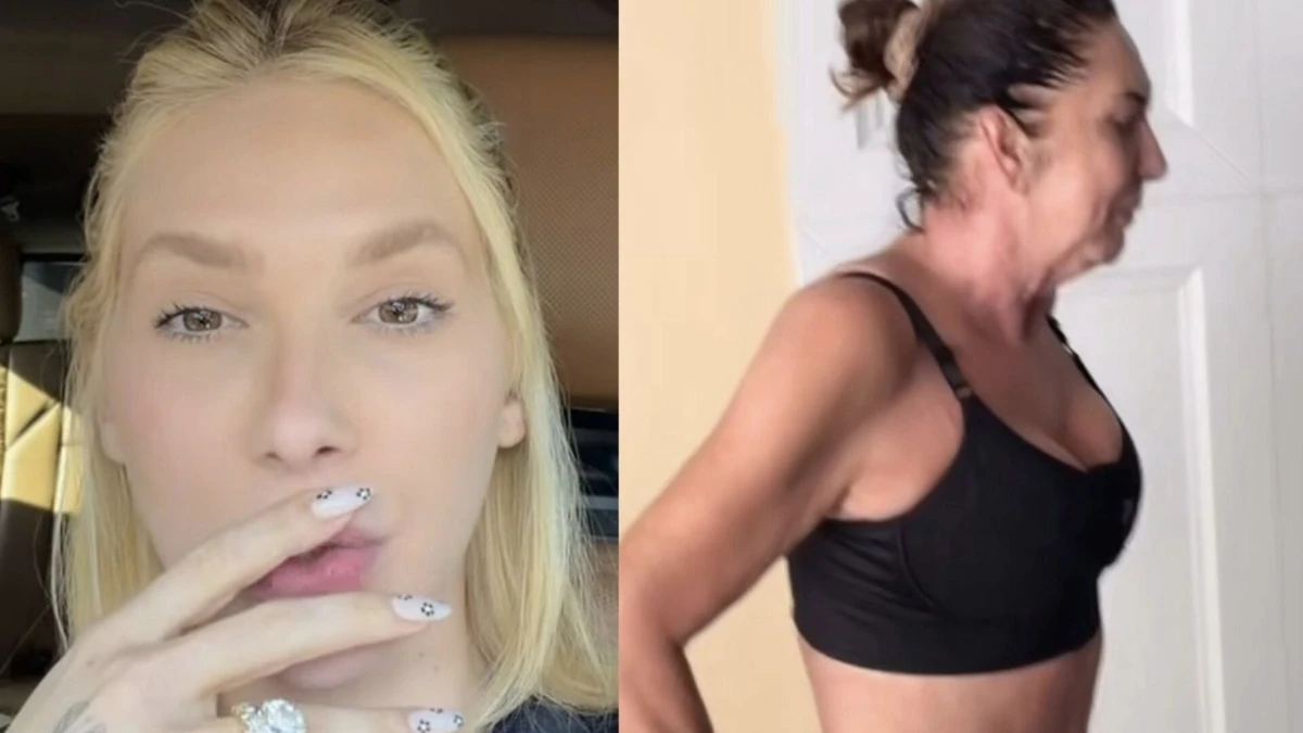 Margareth Serrão surge irreconhecível após plásticas e Virginia reage