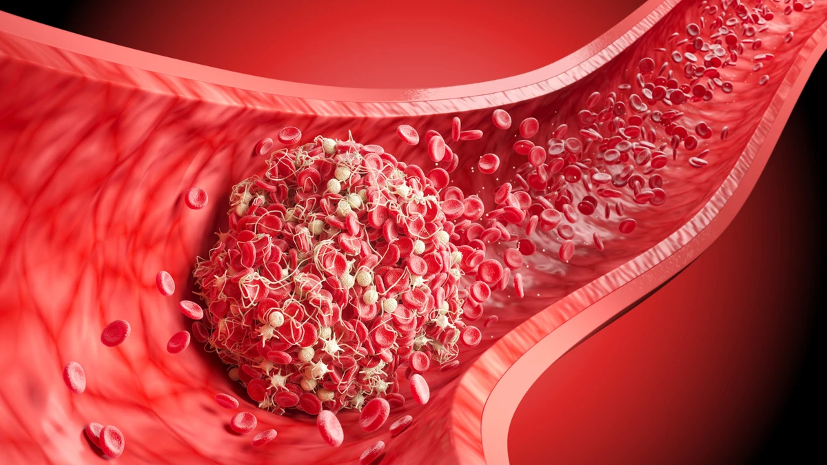 Cientistas são premiados por avanço que pode transformar tratamento da anemia falciforme