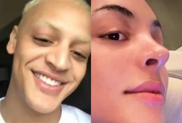 Veja antes e depois das rinoplastias de Pabllo Vittar por Reprodução/Instagram