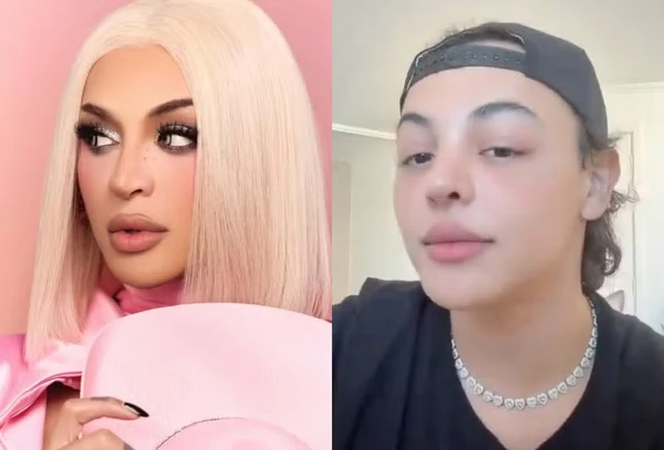 Veja antes e depois das rinoplastias de Pabllo Vittar por Reprodução/Instagram