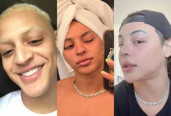 Veja antes e depois das rinoplastias de Pabllo Vittar por Reprodução/Instagram