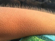 Imagem - Fantasma? Mau olhado? Premonição? O que realmente significa sentir arrepios sem estar com frio