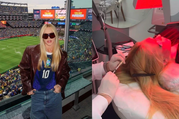 Virgínia, que tem 27 anos, já havia passado por um quadro de alopecia anteriormente