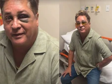 Imagem - Leonardo choca ao aparecer com olho roxo: ‘Levei um susto’