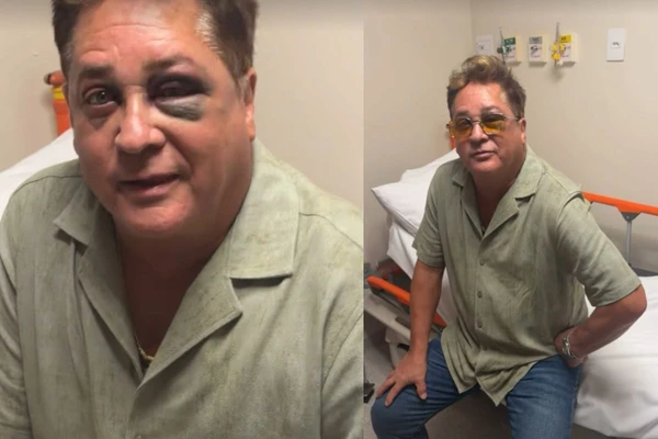 Leonardo preocupou fãs