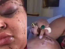 Imagem - Ex-BBB Rízia Cerqueira sofre acidente grave, desmaia e exibe rosto ferido: ‘Arrebentada’