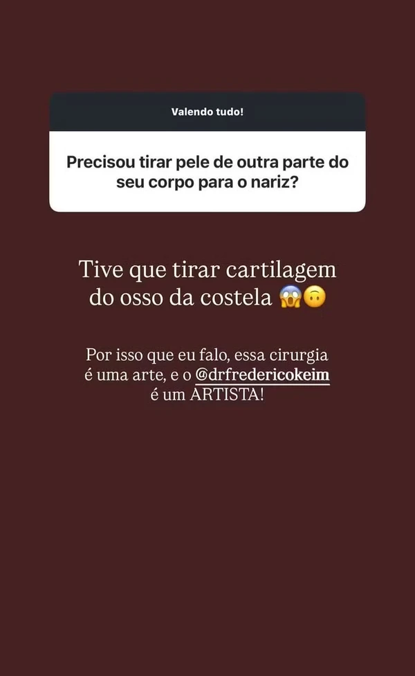 Rafa Justus deu detalhes do procedimento da 2ª rinoplastia