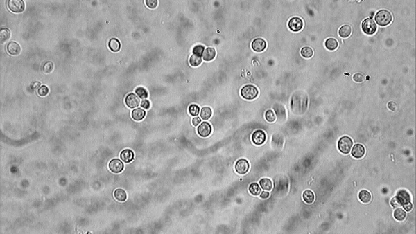 A Saccharomyces cerevisiae aparece em pequenos agrupamentos ao microscópio, o mesmo tipo de organismo usado como modelo para testar resistência celular em laboratório por Savant-fou / Wikimedia Commons