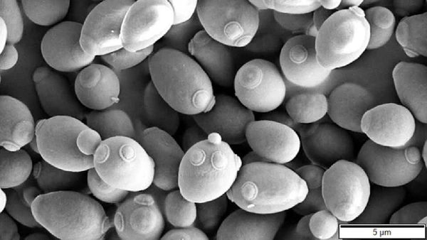 Em microscopia eletrônica, as células de levedura mostram brotamentos e cicatrizes microscópicas, sinais de reprodução em escala de micrômetros por Mogana Das Murtey e Patchamuthu Ramasamy / Wikimedia Commons