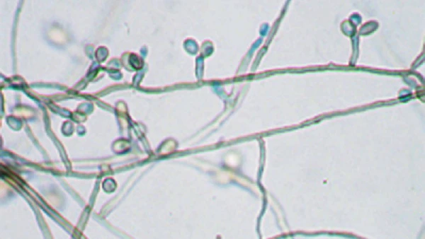 Rhinocladiella similis é conhecido como “levedura negra”, pois possui altas doses de melanina, pigmento que absorve radiação solar.