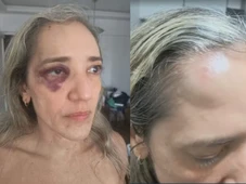 Imagem - Mulher é agredida por motociclista de app após desistir corrida por capacete quebrado