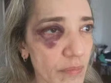 Imagem - Passageira é agredida por motociclista de app após desistir de corrida