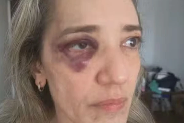Passageira é agredida por motociclista no Rio