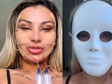 Imagem - Após divórcio, Andressa Urach investe R$ 100 mil em procedimentos estéticos para 'ter 23 anos novamente'