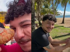 Imagem - Turista morre após comer caranguejo durante viagem a praia famosa do Nordeste