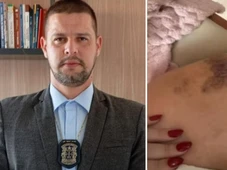 Imagem - Delegado acusado de violência contra a ex na Bahia tem porte de arma suspenso pela Justiça