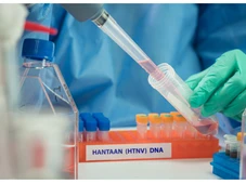 Imagem - Hantavírus pode causar uma nova pandemia? Entenda o que diz a OMS