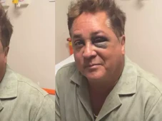 Imagem - Leonardo revela fratura no rosto após queda em pescaria e admite: 'Estava mamado'