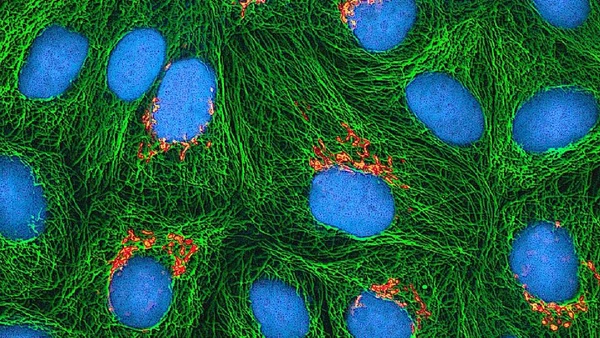 As células HeLa foram, e ainda são, distribuídas em larga escala para todos os tipos de experimento ao redor do mundo
