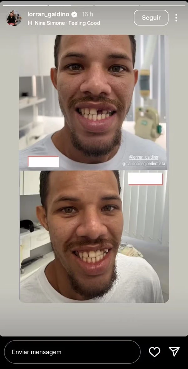 Ator José Loreto leva sósia ao dentista, e Lorran Galdino ganha novo sorriso  por Reprodução/Instagram