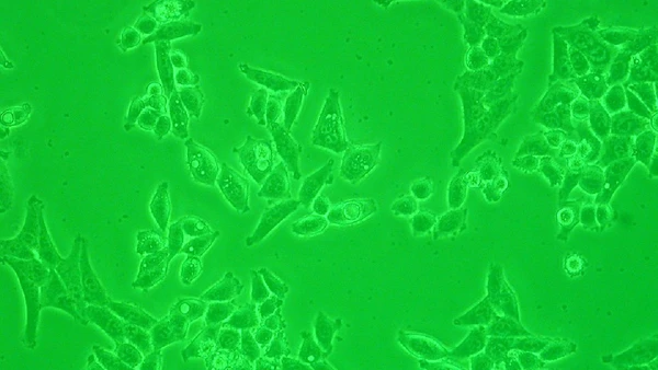 HeLa ajudou a criar métodos para avaliar comportamento tumoral e testar se uma linhagem celular era cancerosa por Gerry Shaw / Wikimedia Commons