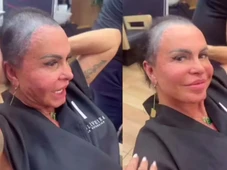 Imagem - Gretchen surpreende ao surgir sem prótese capilar e desabafa: ‘Só fez piorar’