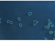 Imagem - O 'arsenal' secreto da salmonela: cientistas descobrem 45 novas toxinas da bactéria por trás das infecções alimentares
