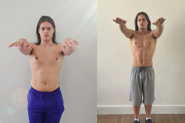Antes e depois de Lucas Cardi