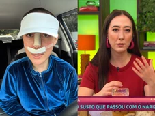 Imagem - Repórter do ‘Mais Você’ revela risco de perder o nariz após erro médico em cirurgia: ‘Pode necrosar’