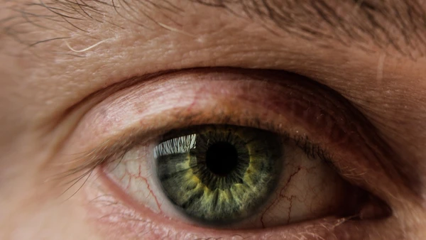 Apesar do nome, olhos verdes não têm pigmento verde; a cor aparece pela interação entre luz e pigmentação