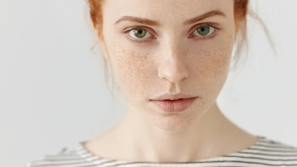 Características como sardas, cabelo claro e cor dos olhos mostram como a herança genética pode criar combinações específicas por Freepik