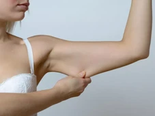 Imagem - Nem pilates nem cardio: veja o exercício mais indicado para reduzir flacidez no braço