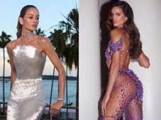 Imagem - O que é ‘ponytail lift’? Estética associada a Izabel Goulart após modelo aparecer com rosto mudado em evento