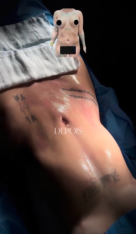 Antes e depois de MC Mirella por Reprodução/Instagram