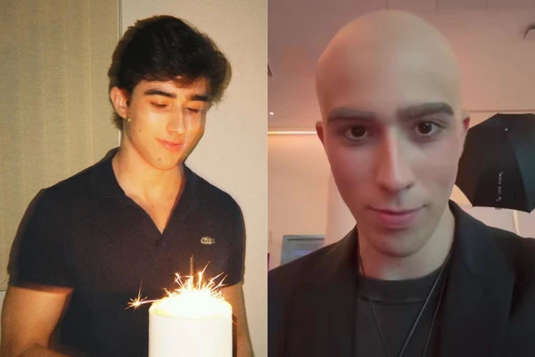 João Pedro Chaseliov: antes e depois