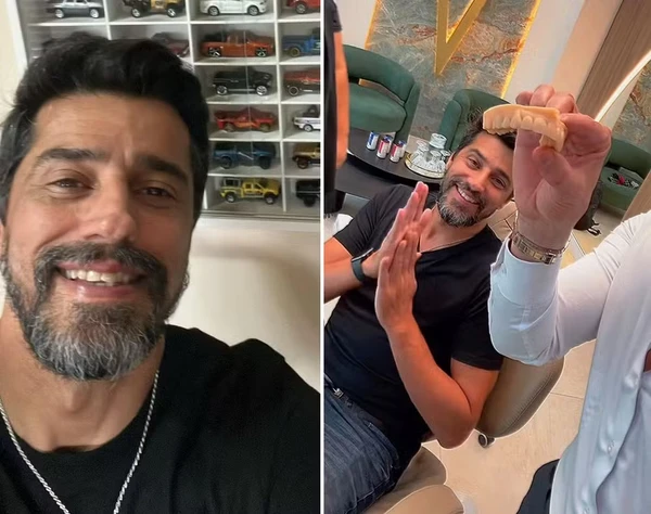 Alberto Cowboy coloca lente nos dentes por Reprodução